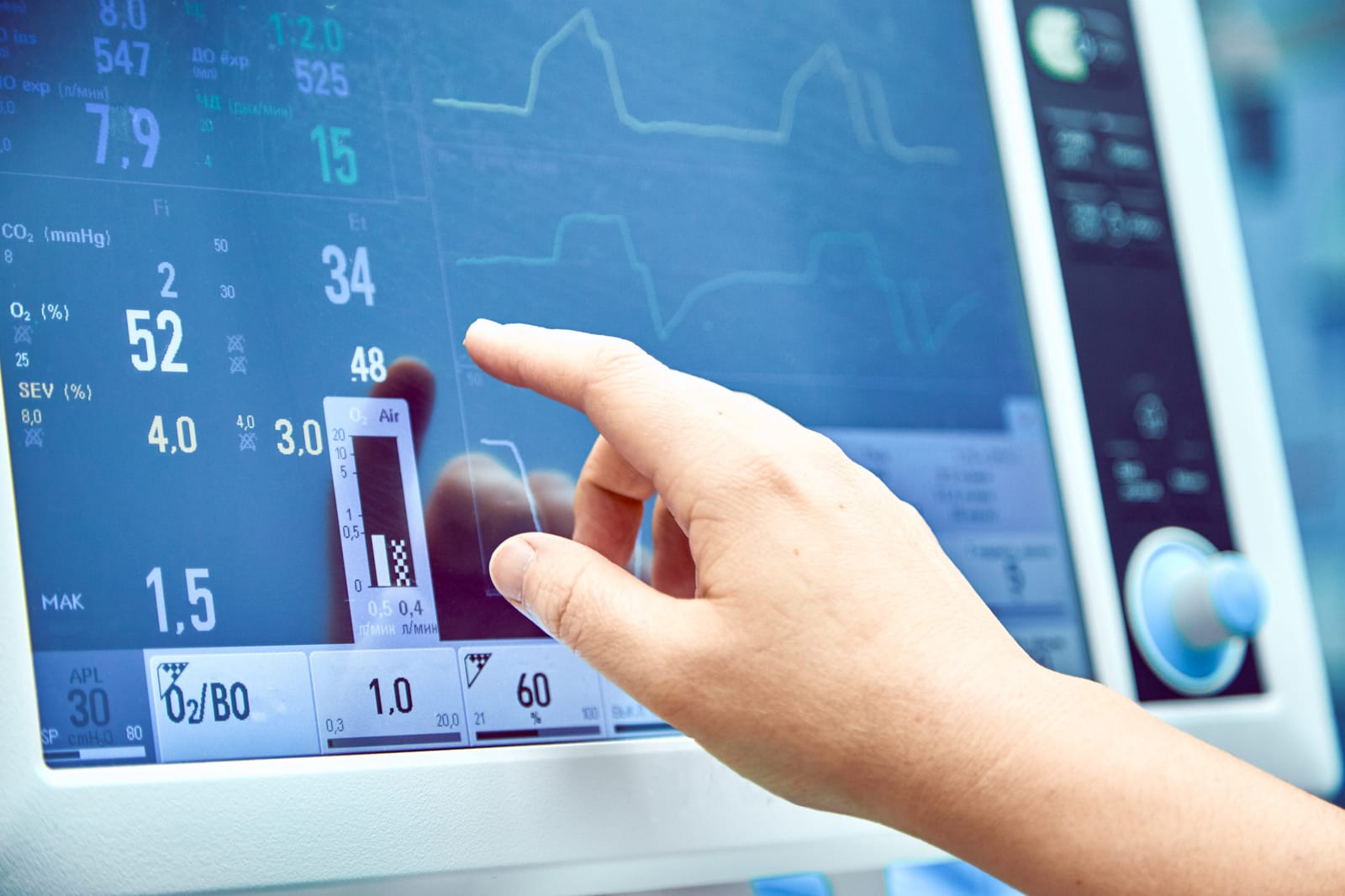 Anaphylaxis during Anesthesia